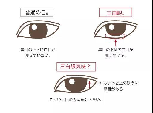 三白眼 甚至 四白眼 啦 由于眼白露出度过高 圈子 新氧美容整形