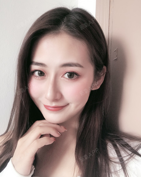 肋软骨隆鼻,超自然鼻子的真实反馈!