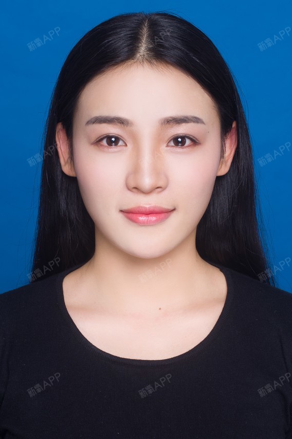 主要是觉得以前单眼皮的_圈子-新氧美容整形