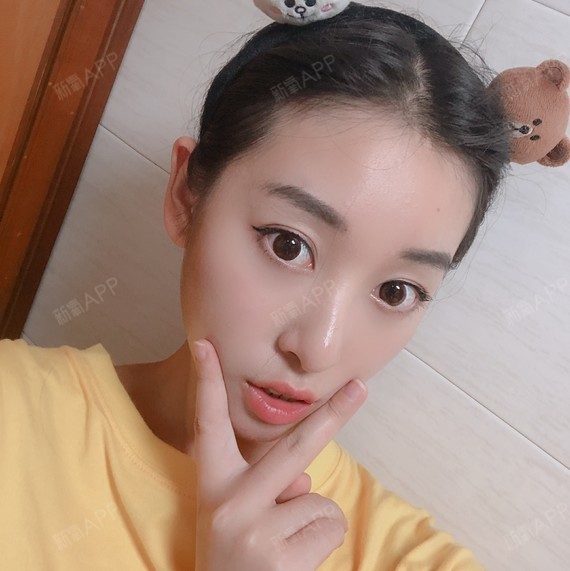 在新氧上魔镜测脸,说我的鼻子是有点鹰钩鼻的,这种鼻_圈子-新氧美容