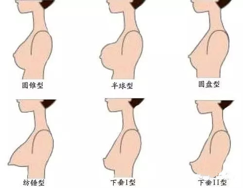 胸型自测 女性胸部的十个标准形状 测一下你的 女性 圈子 新氧美容整形