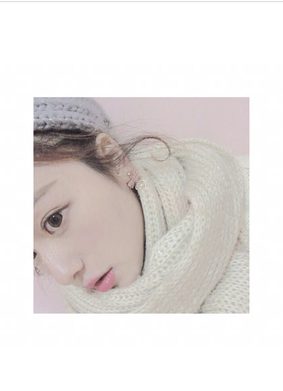 鼻部多项好不好_效果图_人面桃花红鼻部多项术后第263天_新氧美容整形