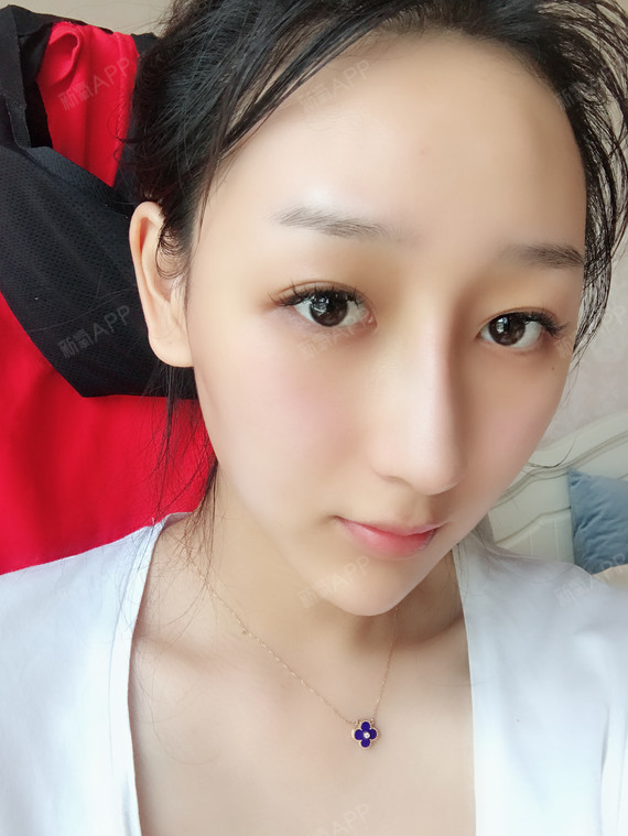 只想垫高鼻梁,为什么医生总是建议做鼻部多项?