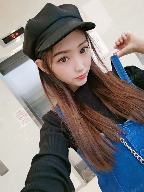 面部吸脂好不好_效果图_氧气3jjho面部吸脂术后第120天_新氧美容整形