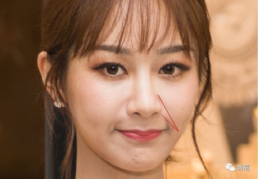 而嘴巴这么用力一抿,不仅加深了她的鼻唇沟,更暴露了鼻基底疑似填充