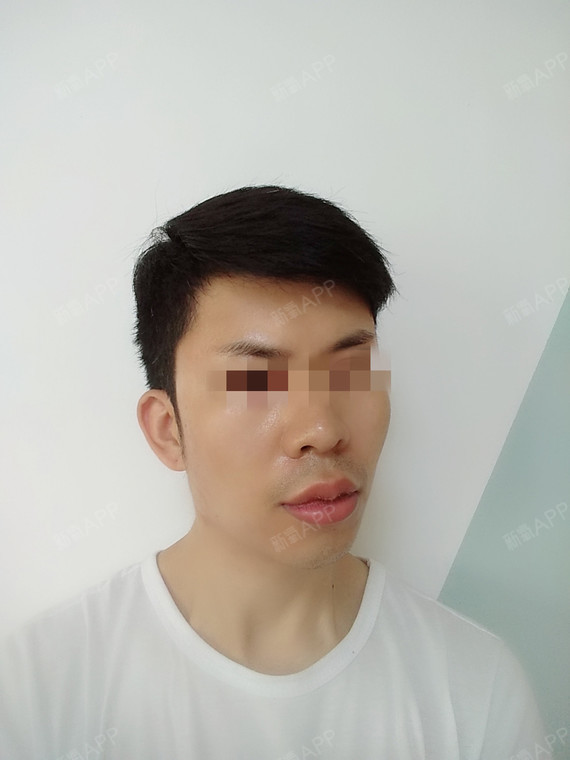 m唇,正确解锁最适合自己的理想唇型