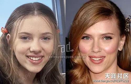 深扒肯豆整容史!