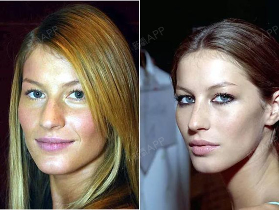 深扒肯豆整容史!