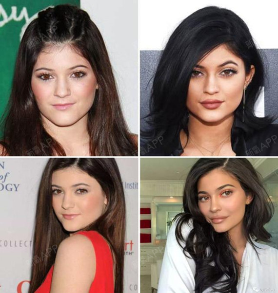 深扒肯豆整容史!