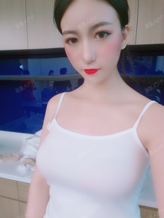 今天我回来医院复查了,正常的恢复程度吧.