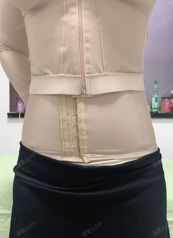 青岛华颜美黄金微雕瘦腰腹术后第16天