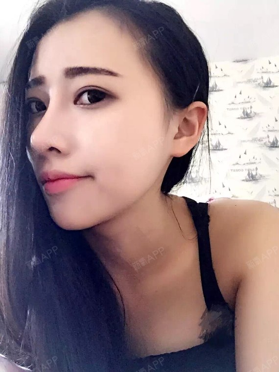 我在做了鼻翼缩小后,鼻孔的形态呈现出了水滴形的美态_圈子-新氧美容