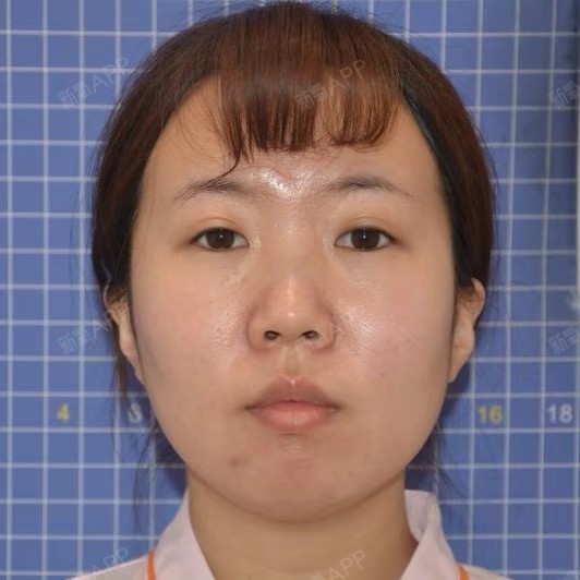 五官不立体?拍照不上镜?看她如何轻松摆脱这些烦恼