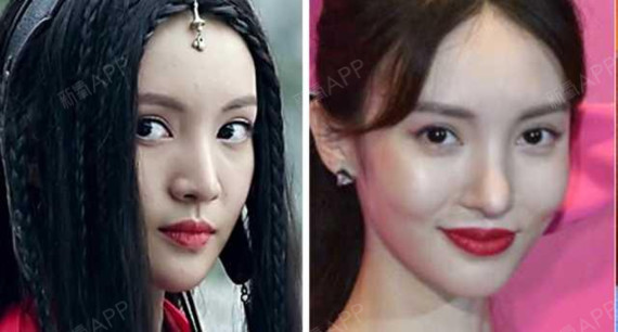 要知道,上一个缩鼻翼出事的女明星还是娜扎,缩鼻翼之后出现