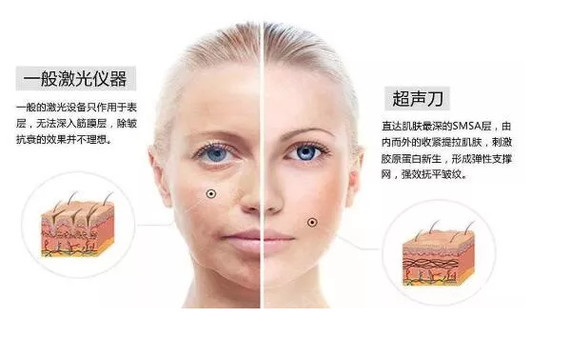 首页 此页面仅支持预览 Avatar 氧气 Dep7c62 87篇日记 超声刀是什么 超声刀多久能看到效果 脸部超声刀有什么危害和副作用吗 面对衰老 化妆已经不能满足人们对美的需求 有的人不远万里 打飞的到泡菜国整容 有些人满意而归 有些人抱憾终身 当