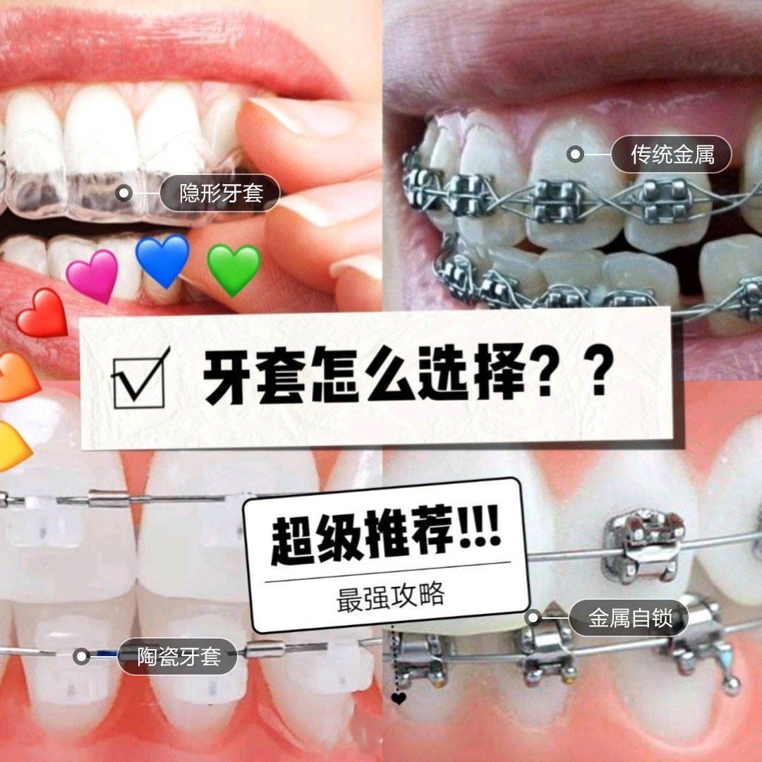 牙齿矫正🚫牙套的几种类型选择[:63][:66][_圈子-新氧美容整形