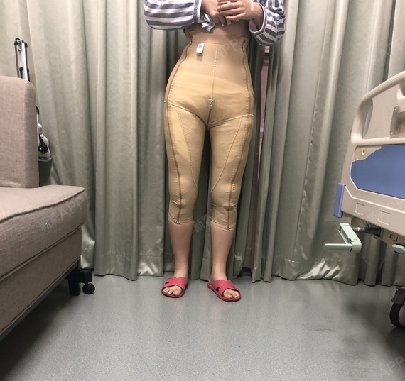 右侧屁股肿大挂什么科女（屁股右边肿大必要
做什么查抄
）《屁股右边肿大需要做什么检查》