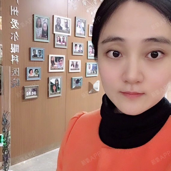 右眼近视400度,散光25度