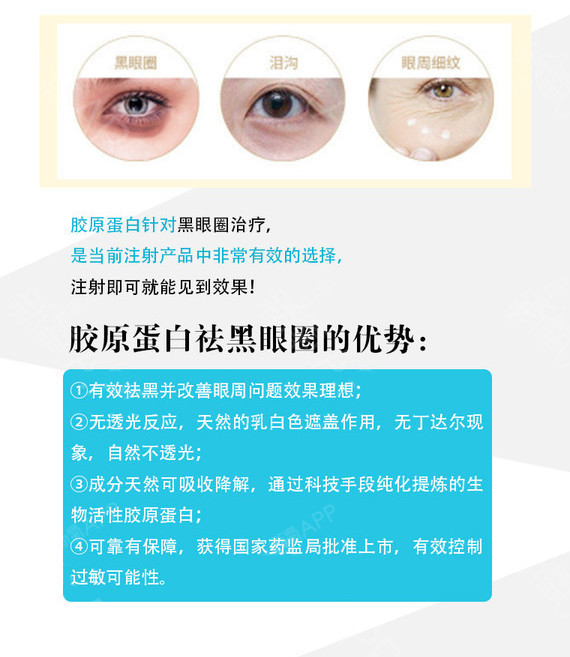 【其他填充剂】【肤美达胶原蛋白】填充苹果肌/填充泪沟/祛黑眼圈/祛