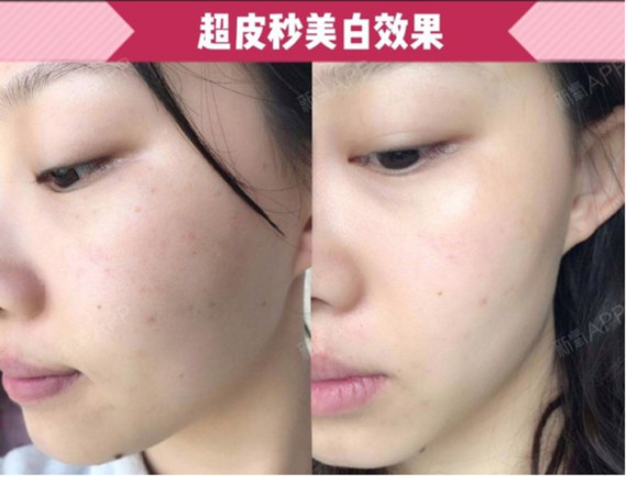 (白瓷娃娃这对比也太令人心动啦)