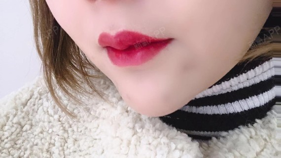 m唇加花瓣唇今天半个月了哟,爱了爱了,我的嘴巴原来_圈子-新氧美容