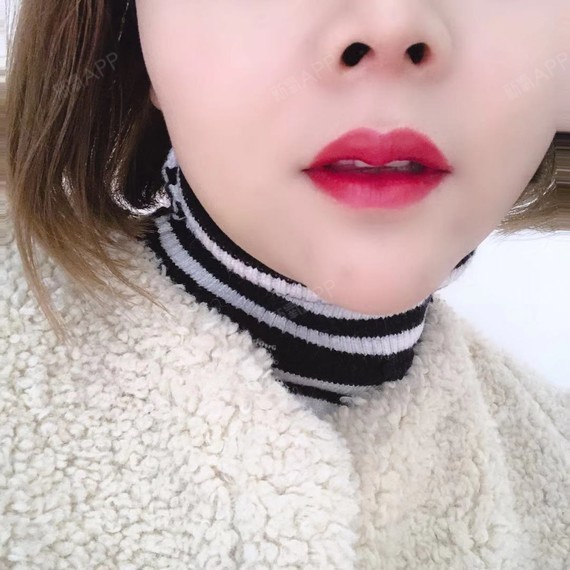 m唇加花瓣唇今天半个月了哟,爱了爱了,我的嘴巴原来_圈子-新氧美容