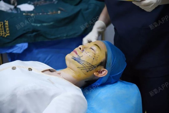 线雕术后饮食注意事项了解一下.