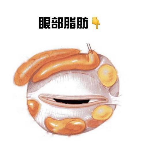 眼部类型多种多样,肿泡_圈子-新氧美容整形