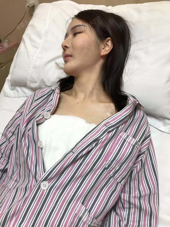 刚做完假体隆胸的前两天基本就在床上躺着休息,刚做完_圈子-新氧美容