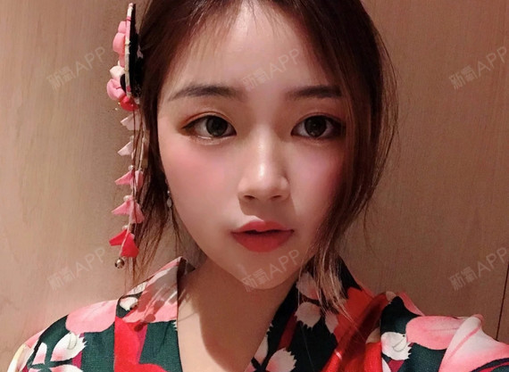 广西壮族自治区南宁眼部多项好不好_效果图_氧气3vcpr眼部多项术后第
