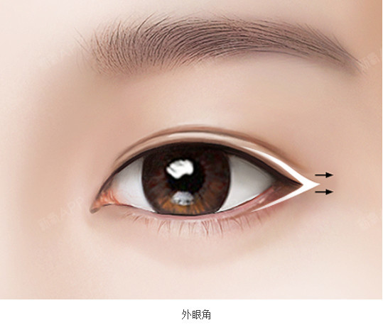 切开眼角外侧粘膜,加长眼裂长度,使眼睛纤长优美.