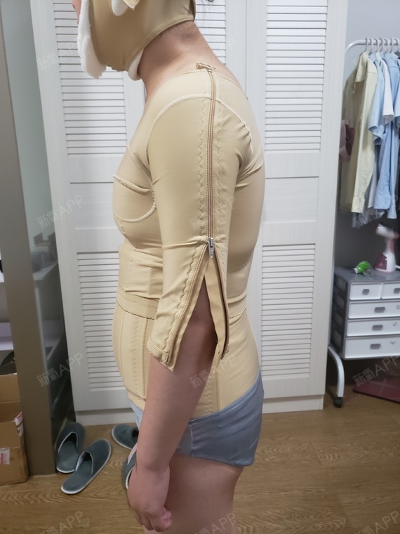 上半身吸脂第一天好难受啊整个腰腹背都抽了脂胖就是这么遭罪正在吃的