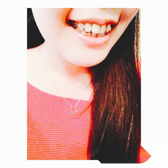 我知道你们想看效果图 哈哈哈以上是戴牙套四个月的成_圈子-新氧美容