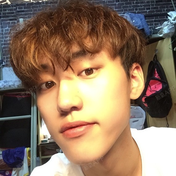 之前我的鼻子不好看,鼻梁很低,_圈子-新氧美容整形