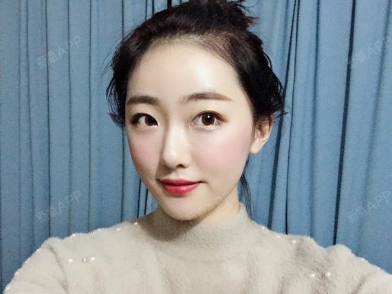苏州自体脂肪丰卧蚕好不好_效果图_太阳总会跳出海平面自体脂肪丰卧蚕