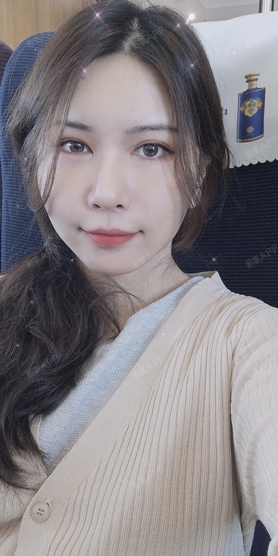 自体脂肪填充面部吸脂术后第7天