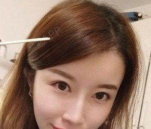 二次生长出来的头发也很长了,现在我的额头显着就不那么大了