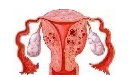 做完人流后子宫图片人工流产后子宫的样子图片打过胎的宫颈图示人流后