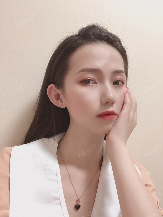 瘦脸针效果更明显了9699_圈子-新氧美容整形