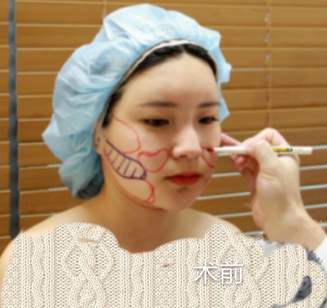 整理面吸你们想要知道点