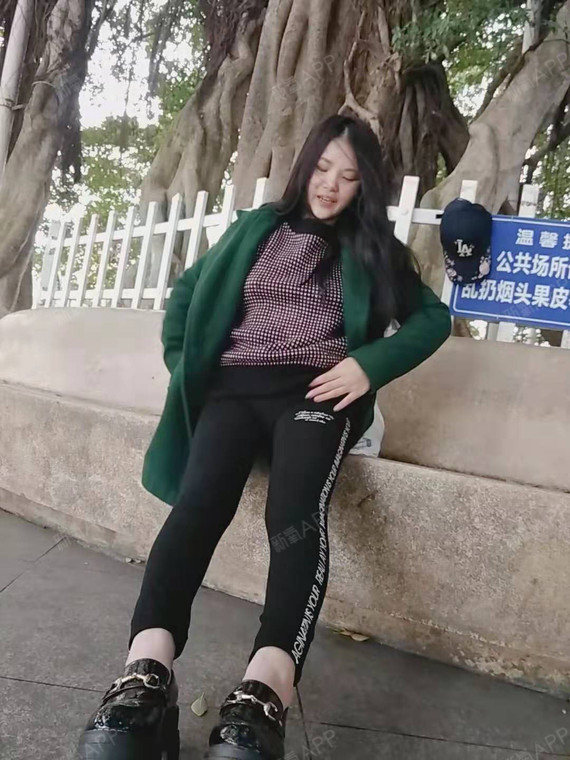 今天特意到公园拍了几张照片,发现大腿上越来越瘦了,_圈子-新氧美容