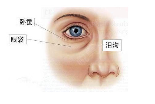 追缉眼袋形成的元凶深度解密眼袋