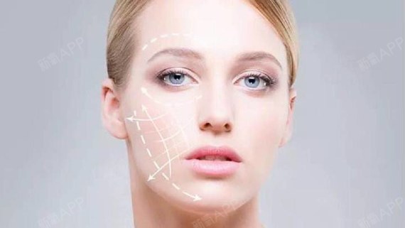 线雕 ppdo埋线提升 面部提升是什么?