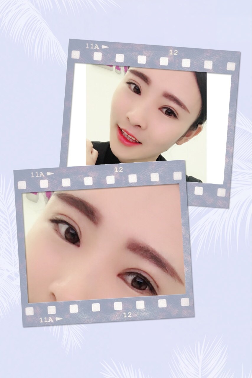 【高健】- 新氧美容整形