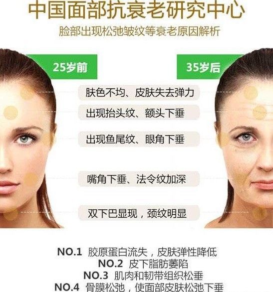 之后填充剂补充容积缺失和静态皱纹,肉毒素动态皱纹,最后