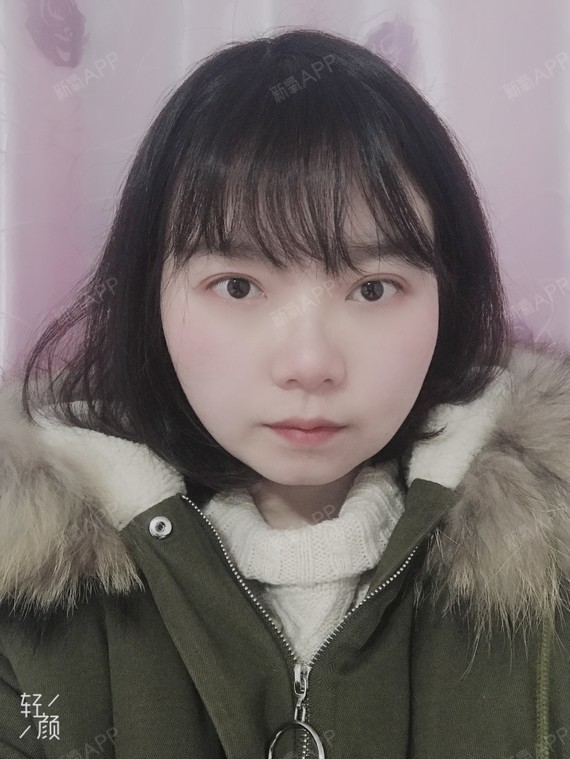 已经五个多月了,解决了大饼脸和眯眯眼,整个人的气质_圈子-新氧美容