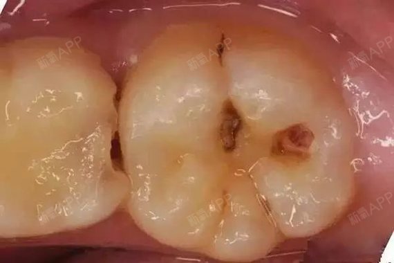 我们叫六龄牙,是四胞胎兄弟