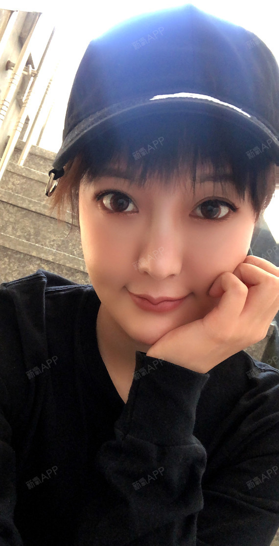 沈阳m唇手术好不好_效果图_你看过的温柔べm唇手术术后第105天_新氧