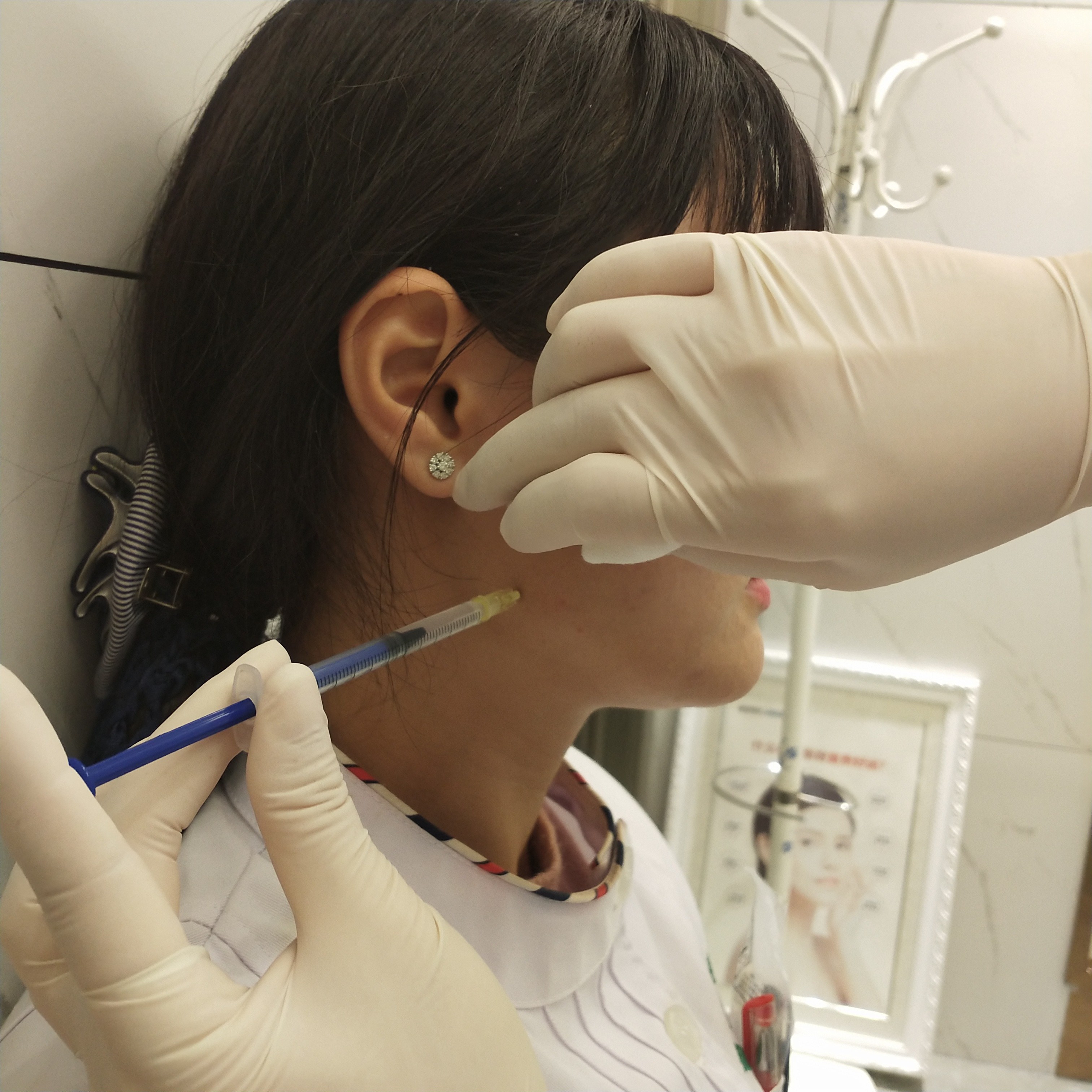 我是第一次来打瘦脸针,没打之前一直以为会很痛,还跟医生强调了又强调