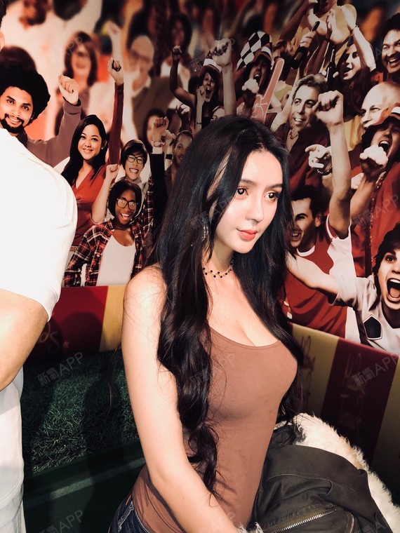 成都假体隆胸好不好_效果图_李紫琪假体隆胸术后第74天_新氧美容整形